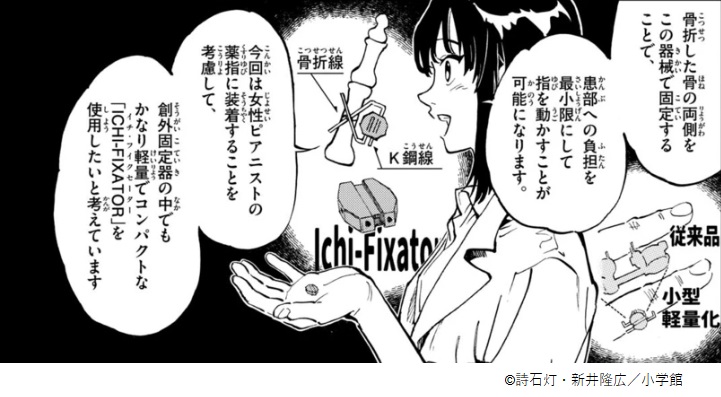 弊社製品ICHI-FIXATORが漫画『テノゲカ』に掲載されました - 医療機器